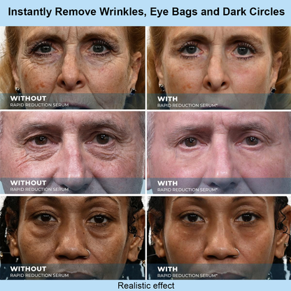 Results In 60 Seconds - Lunivéa™ Rapid Wrinkle-Reducing Serum for Wrinkles, Bags & Dark Circles