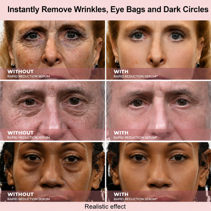 Results in 60 Seconds - Lunivéa™ Rapid Wrinkle-Reducing Serum for Wrinkles, Bags & Dark Circles