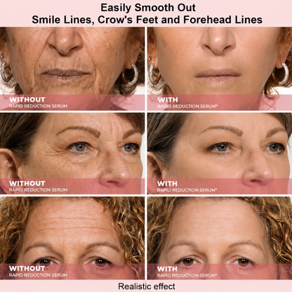 Results in 60 Seconds - Lunivéa™ Rapid Wrinkle-Reducing Serum for Wrinkles, Bags & Dark Circles